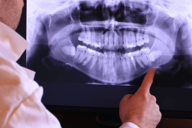 Best Emergency Root Canal Treatment in Muscoda, WI