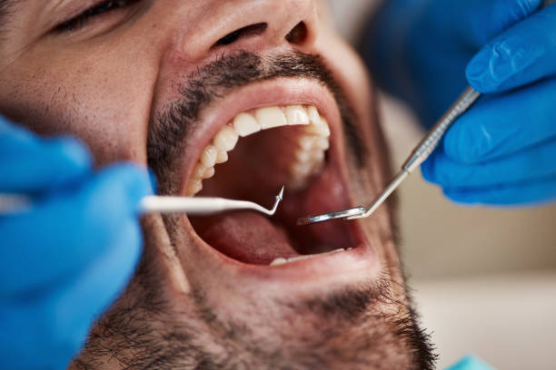 Best Emergency Wisdom Teeth Removal in Muscoda, WI
